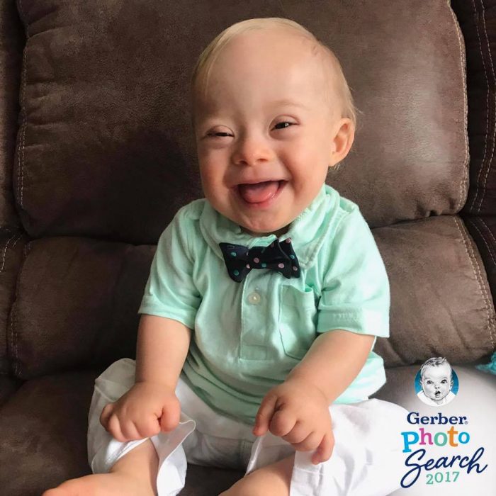 Image of Gerber baby who has Down Syndrome