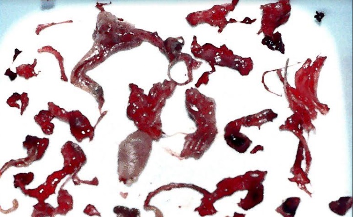 Image: Parts of aborted babies 