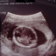 abortion, Planned Parenthood