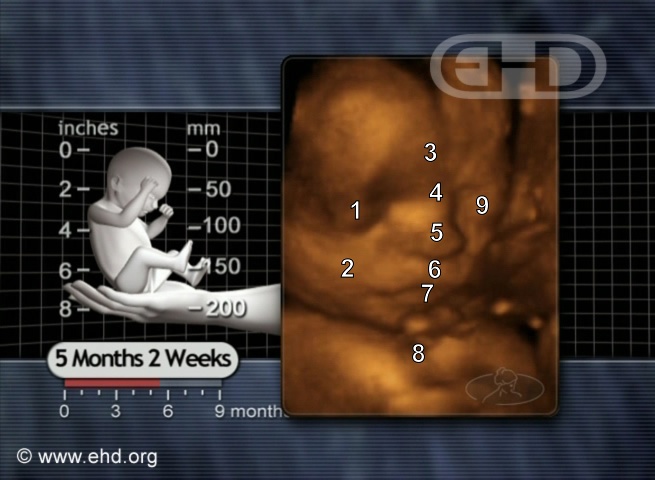 late-term abortion, ultrasound