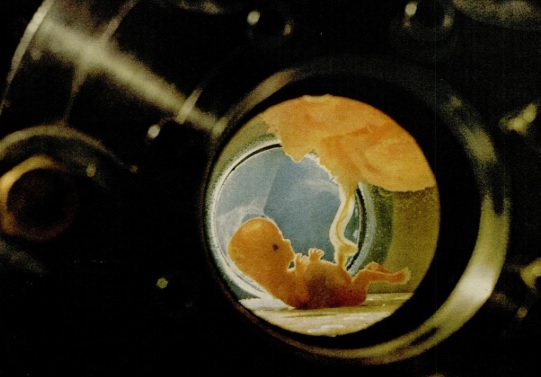 Image: 10 week old Fetus kept alive via artificial womb (Image credit: Life Magazine Sep 10, 1965)