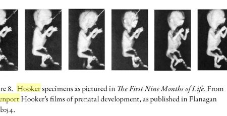 Image: Davenport Hooker fetal specimens featured in First Nine Months of Life (Image credit: Icons of Life: A Cultural History of Human Embryos)