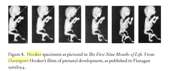 Image: Davenport Hooker fetal specimens featured in First Nine Months of Life (Image credit: Icons of Life: A Cultural History of Human Embryos)