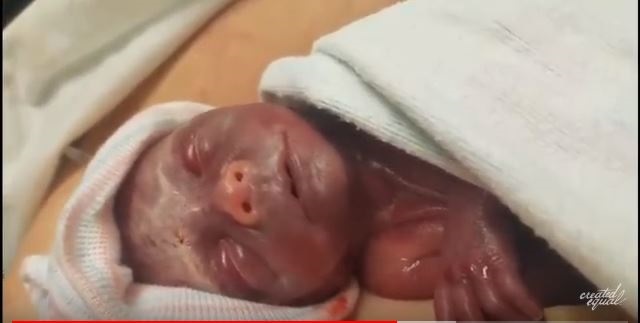 Baby Elliot was born premature and doctors refused to help him.