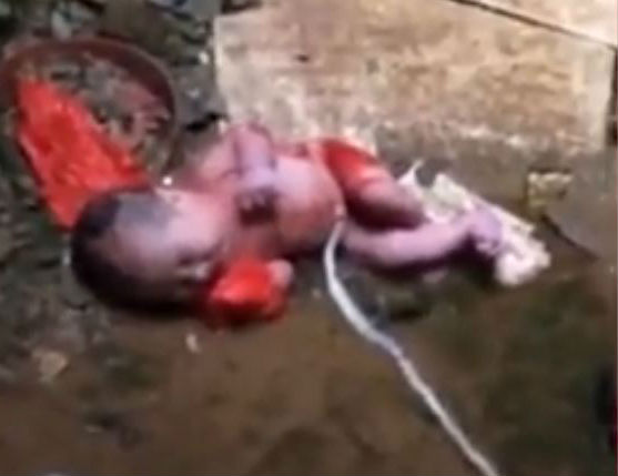 baby victim