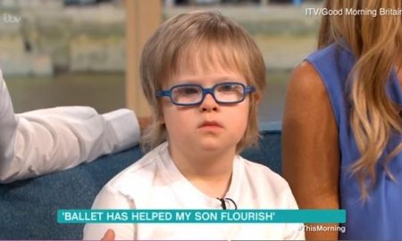 Down syndrome