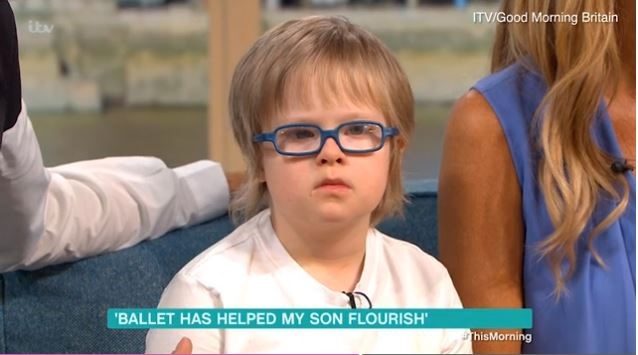 Down syndrome