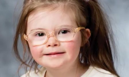 down syndrome campaign