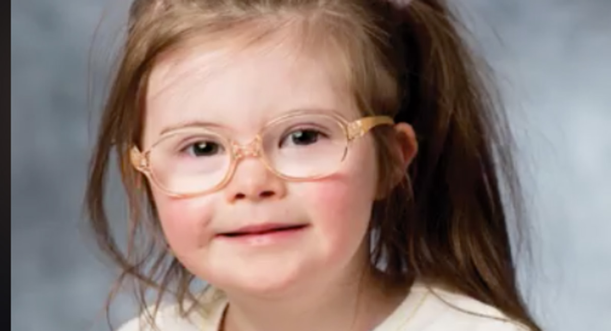 down syndrome campaign