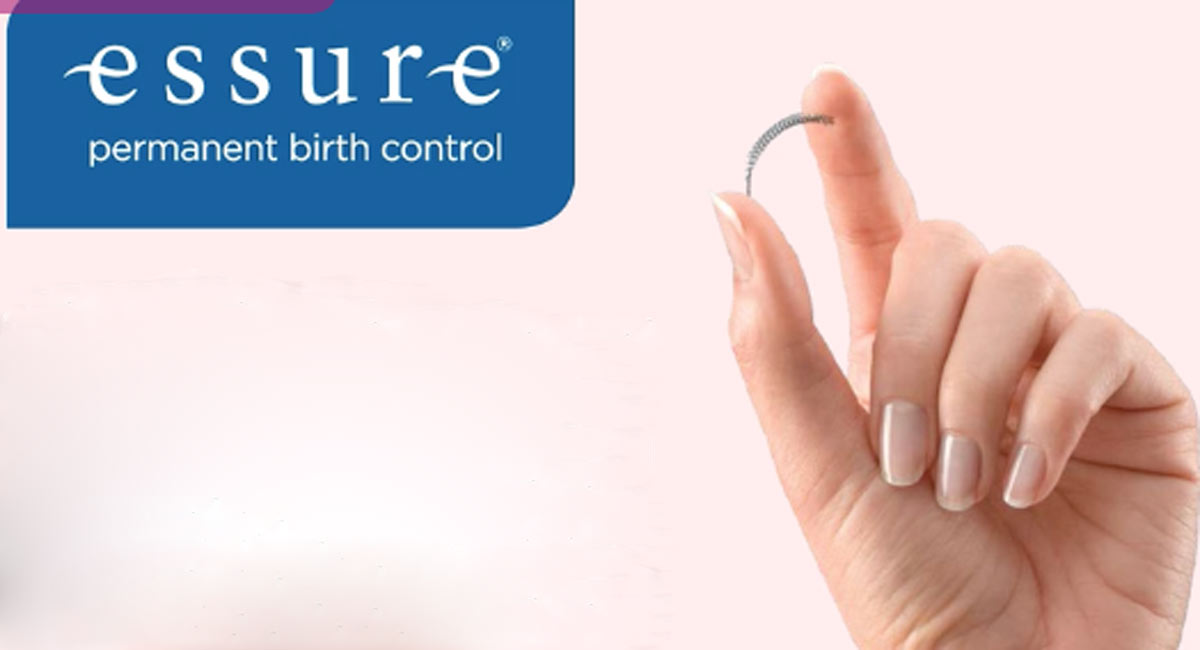 Essure, birth control, contraceptives