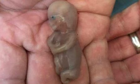 miscarried, miscarriage
