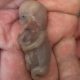 miscarried, miscarriage