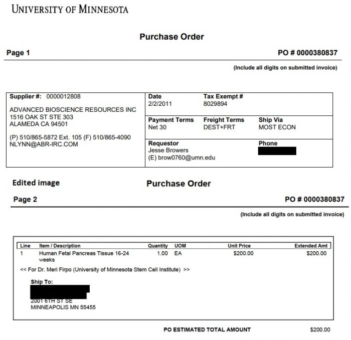 Image: ABR contract with U of Minnesota for fetal tissue 2011