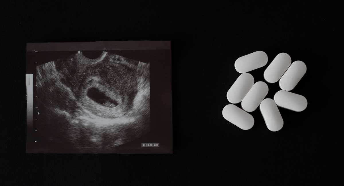 abortion pill, Israel abortion, georgia