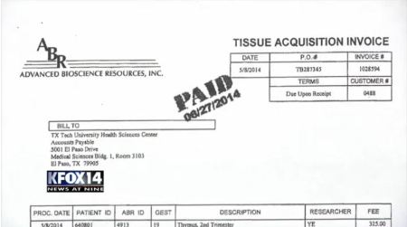 Image: ABR invoices for fetal tissue to Texas Universities 