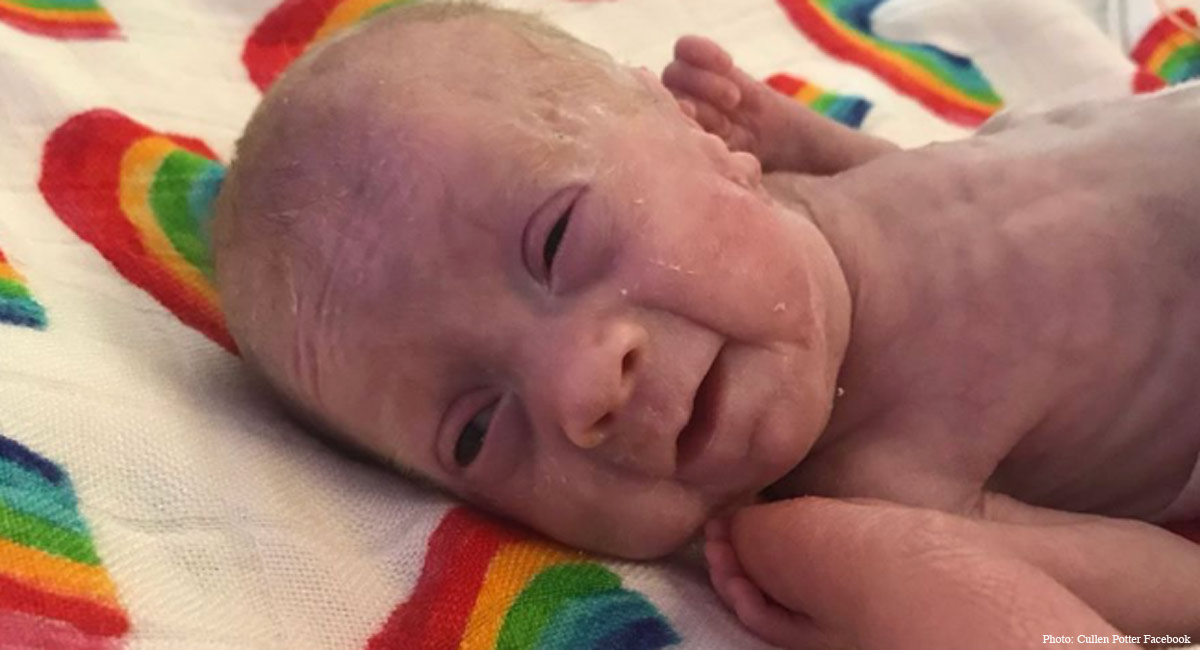 Cullen Potter, premature baby