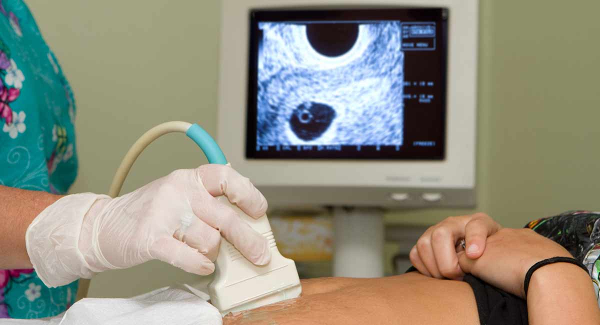 pregnancy center, heartbeat, pregnant, ultrasound