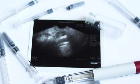 reproductive technology, IVF, fertility treatments