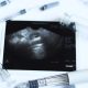 reproductive technology, IVF, fertility treatments, donor