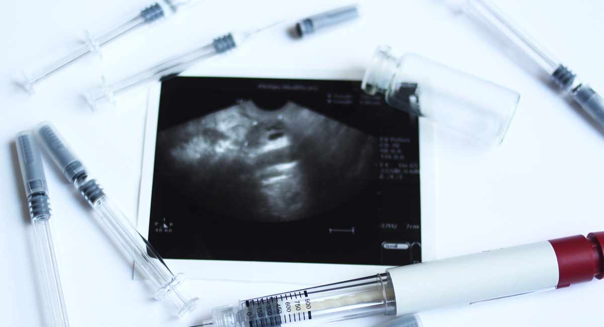 IVF, preborn