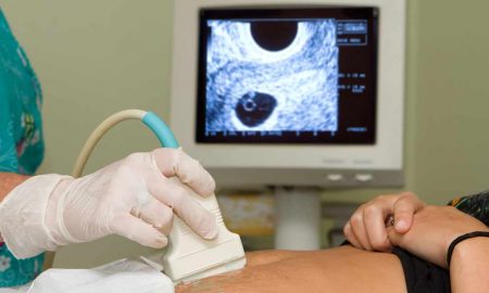 ultrasound, pregnancy centers