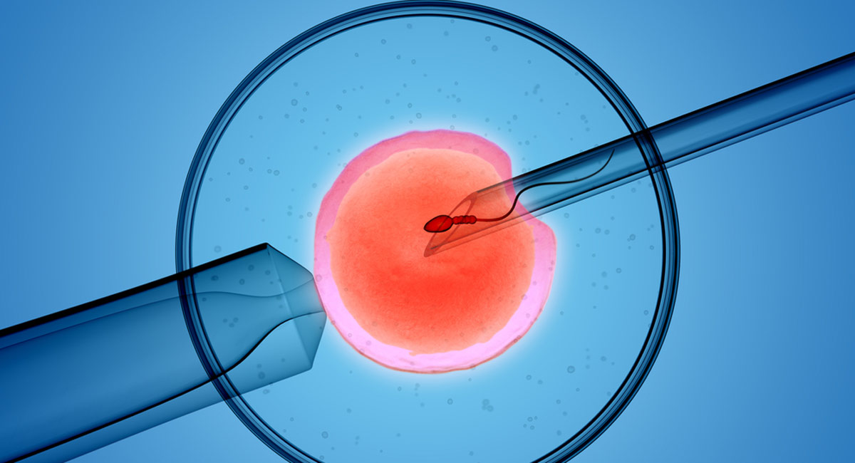 IVF sperm donor