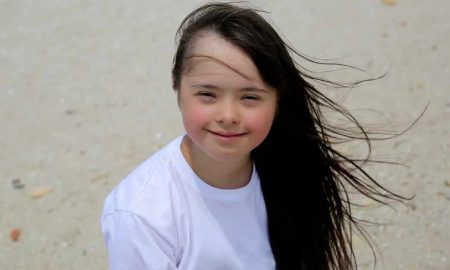 down syndrome girl