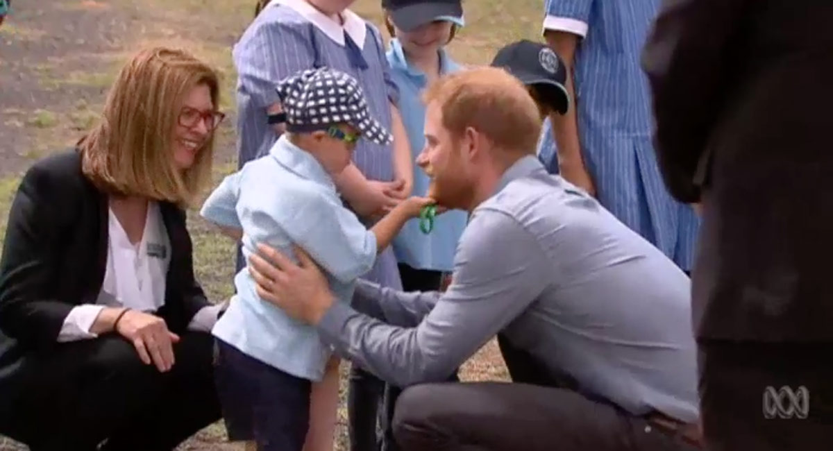 prince harry down syndrome