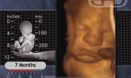 Gosnell, stillborn, 7 months