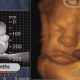 Gosnell, stillborn, 7 months