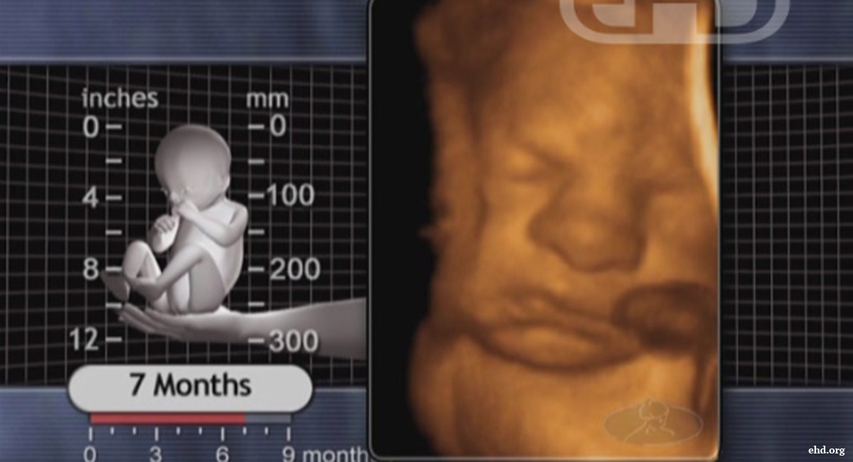 Gosnell, stillborn, 7 months