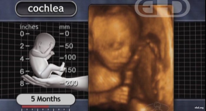 late-term abortionist, second trimester