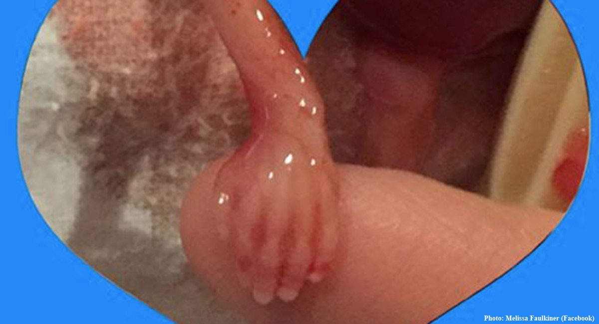 Baby Rylan, miscarried at 15 weeks