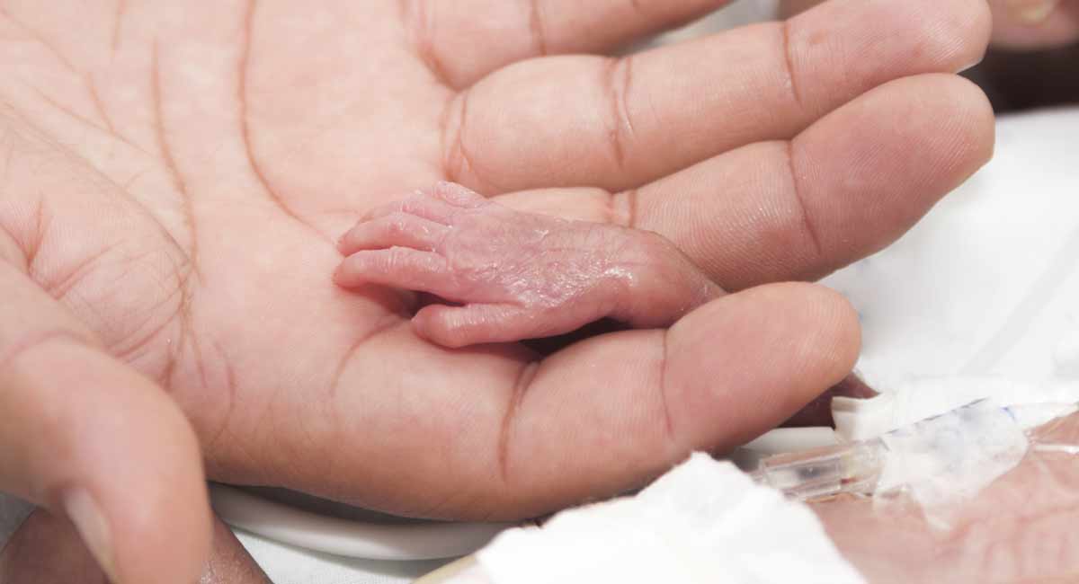 premature, born alive, Rhode Island, abortion