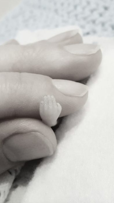 miscarried, miscarriage, 14 weeks