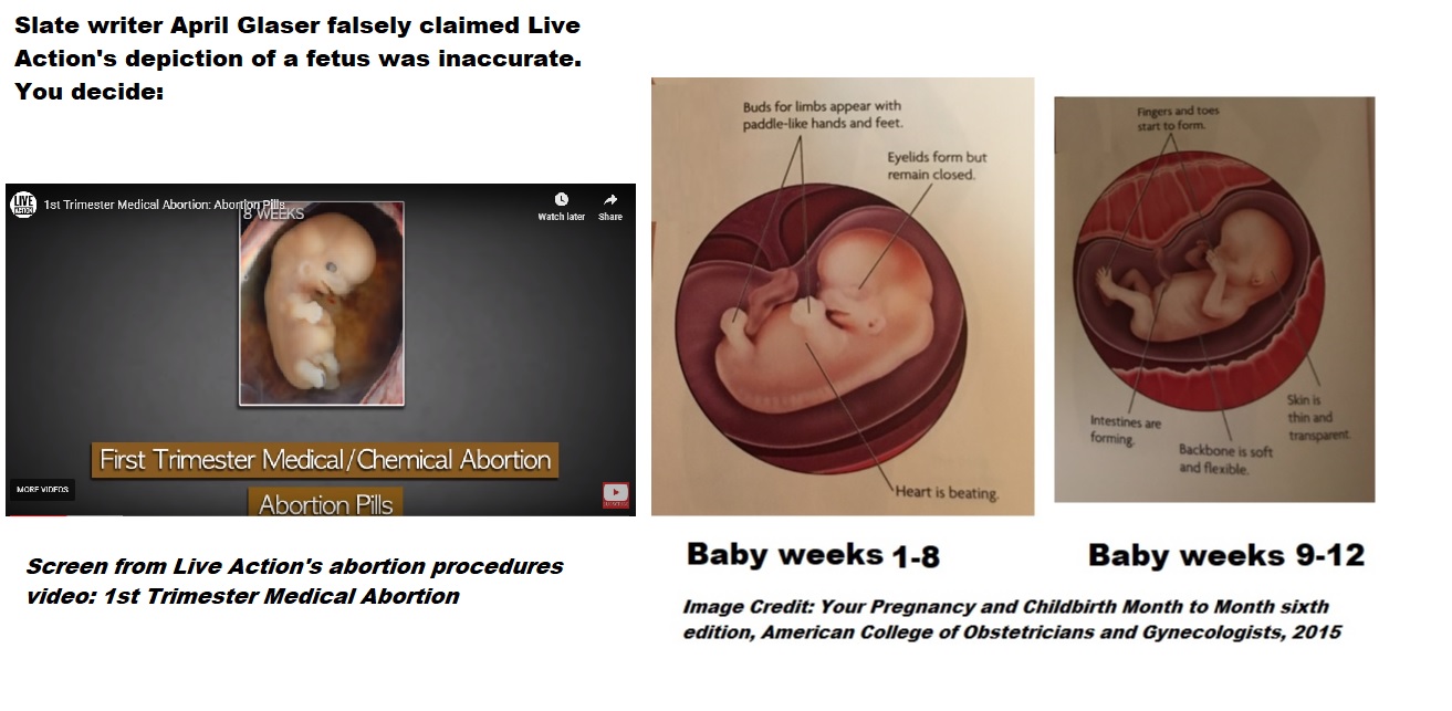 Image: Live Action abortion procedure vid v ACOG 1st trimester fetal development 