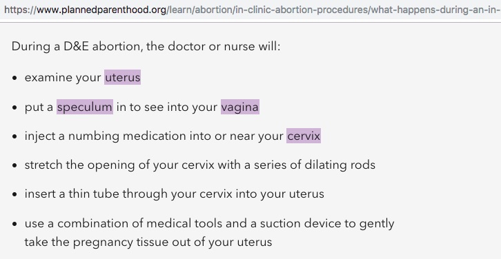 Not the full facts - Planned Parenthood D&E Abortion