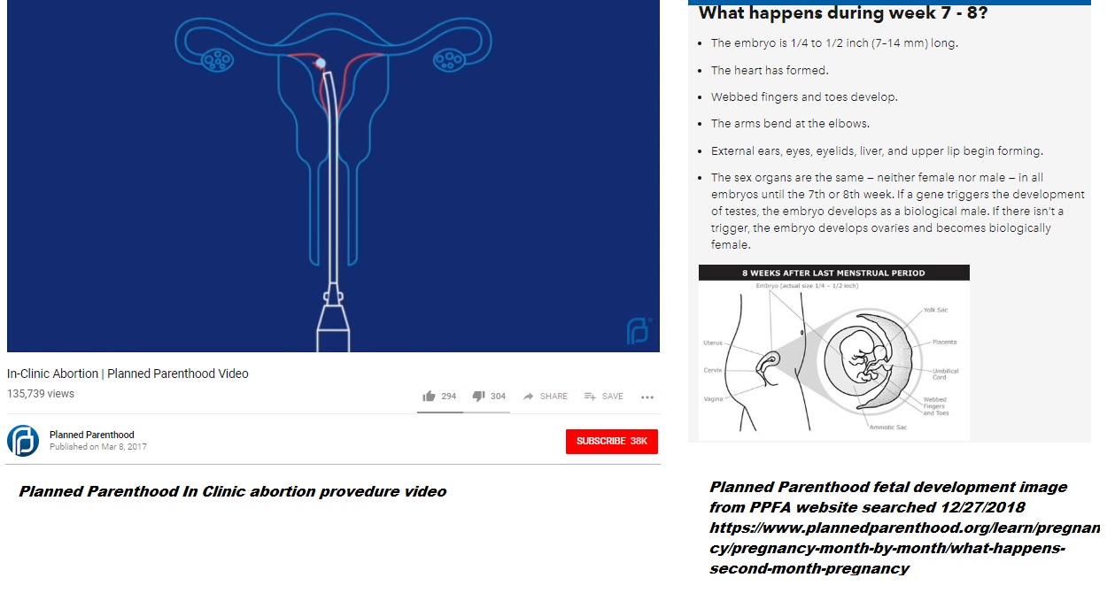 Image: Planned Parenthood in clinic abortion shows baby as dot v 7 to 8 week pregnancy