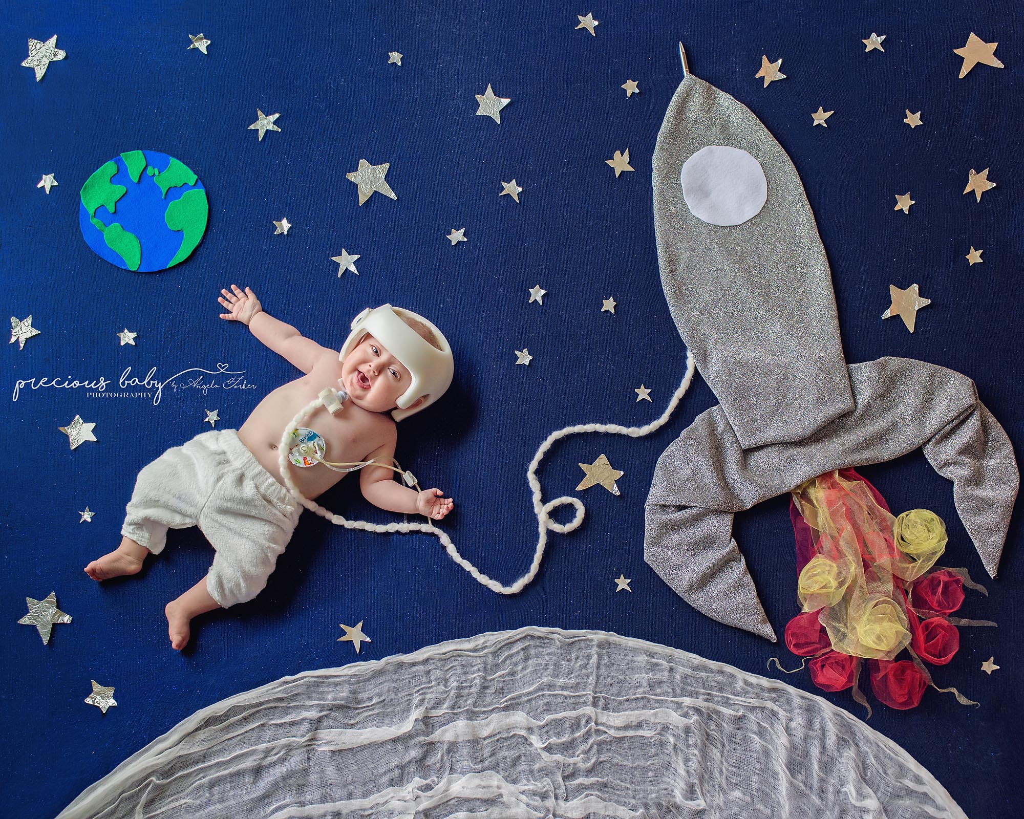 babies with medical needs, photographer