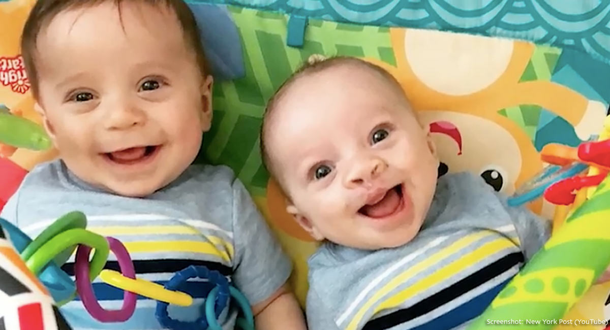 friend said abort baby cleft palate