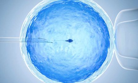 IVF, abort