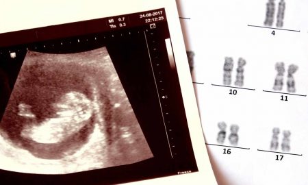abortion, pregnancy, Louisiana, ultrasound, heartbeat