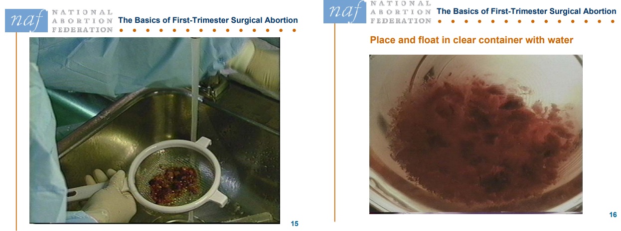 USF Articles only Image: NAF Slide straining and backlighting the products of pregnancy
