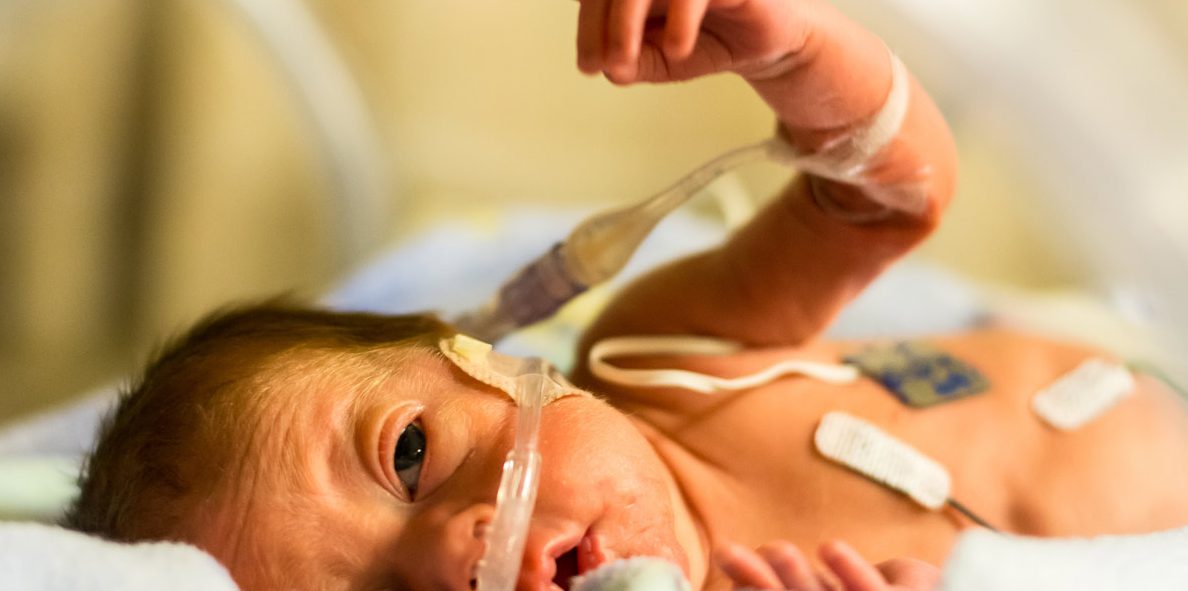 preemie, hand, abortions, abortion survivors