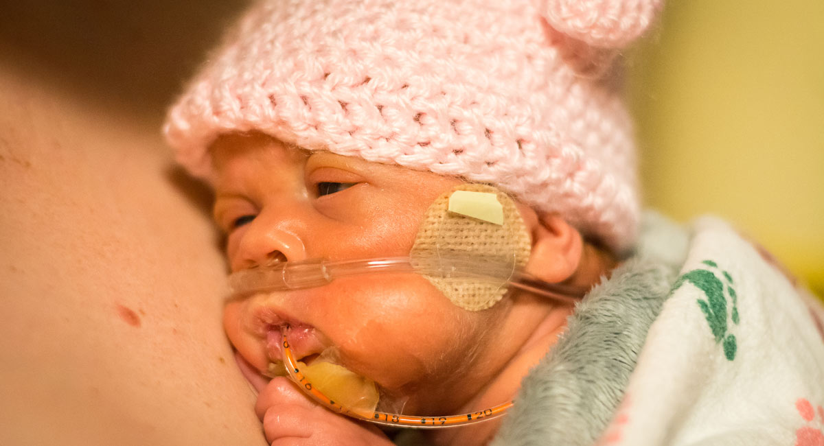 preemie, born alive