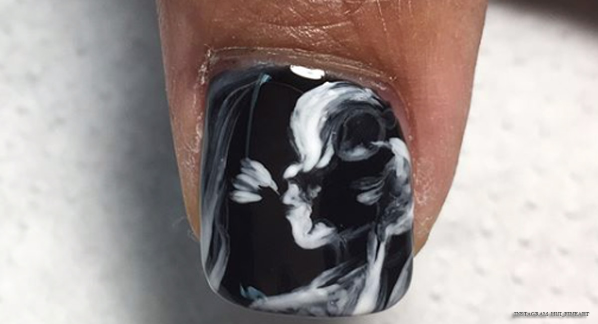 ultrasound