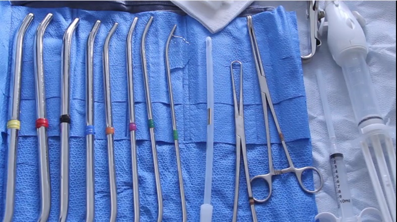 Image: Metal Dilators and MUA for abortion