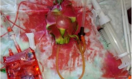Image: TEACH UCSF abortion training uses pitaya of dragonfruit to simulate abortion complications