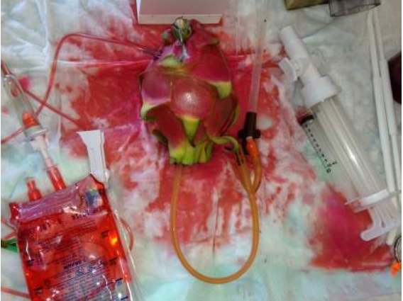 Image: TEACH UCSF abortion training uses pitaya of dragonfruit to simulate abortion complications