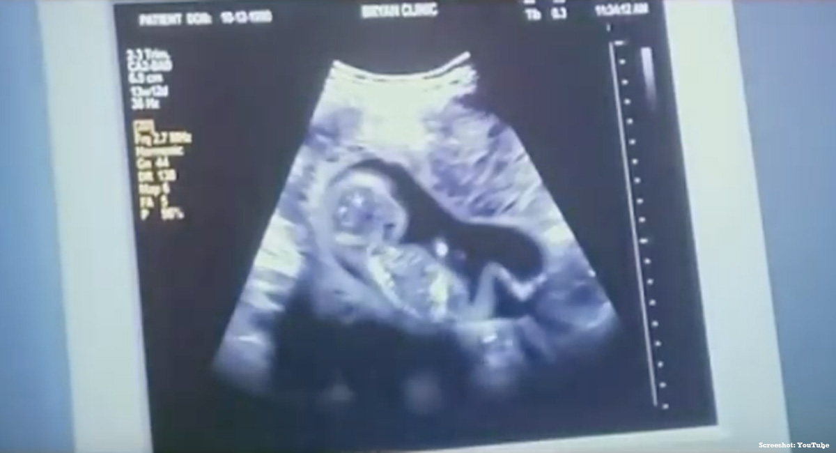 Unplanned abortion